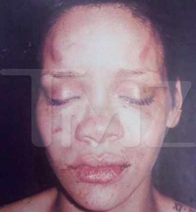rihanna pictures beat up. Rihanna told police she tried