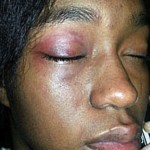 UPDATE: Sharkeisha ‘Beatdown’ Victim Speaks! Meet Shamichael Manuel… [PHOTOS + VIDEO]