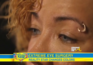 Tiny Harris Eye Color Surgery - StraightFromTheA 1