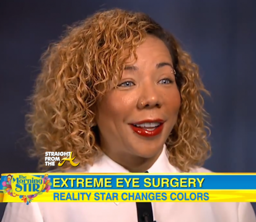 Tameka Cottle Eye Surgery